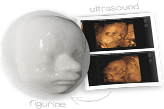 Ultrason İle Bebeğinizin 3 Boyutlu Profilini Alın
