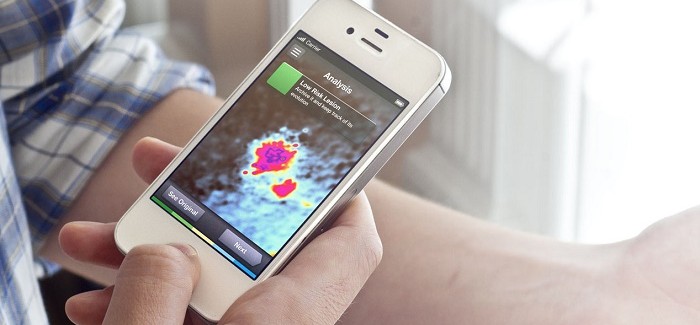 Cilt Kanseri Analizi Yapan İlk Resmi Mobil Uygulama: SkinVision