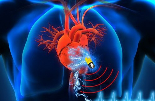 Vücut Sıvısını Yakıt Olarak Kullanabilen Kalp Pili Üretildi