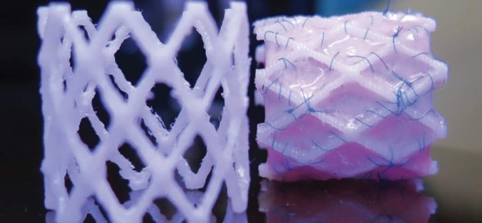 Çocuk Kalp Ameliyatları İçin 3D Yazıcıyla Stent Üretildi