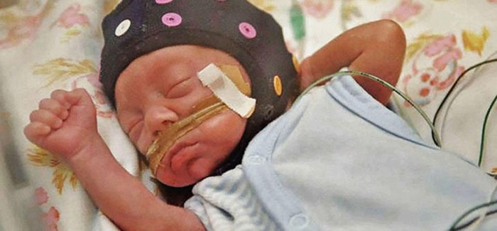 Yapay Zekâ Prematüre Bebeklerde Beyin Gelişimini Ölçecek