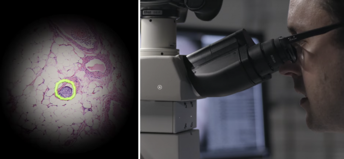 Google’ın Yapay Zeka ve Artırılmış Gerçeklikle Donattığı Mikroskoplar Kanser Teşhisini Kolaylaştıracak
